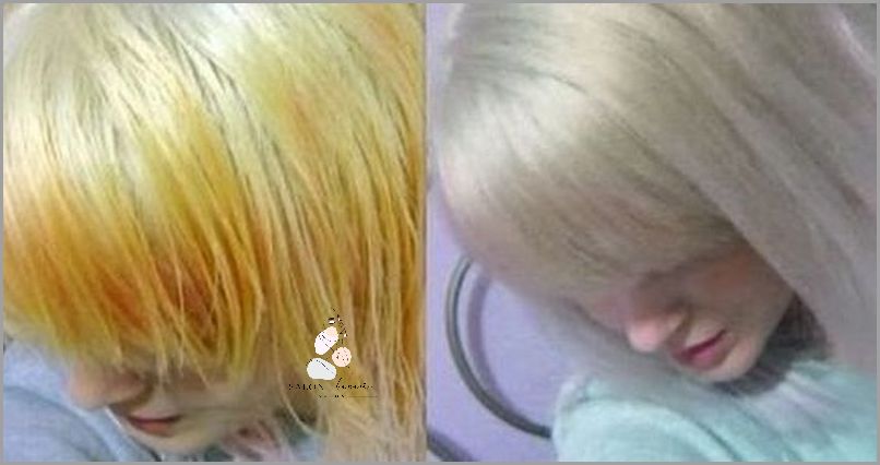 Jak Natychmiast Pozbyć Się Siniaka!