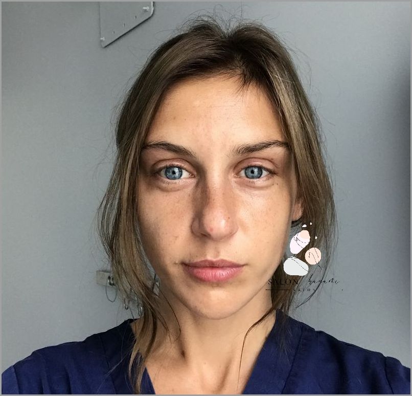 Lekarze Przestrzegają: Szczepienia Na Żółtaczkę Przed Operacją! Lekarze Przestrzegają: Szczepienia Na Żółtaczkę Przed Operacją!