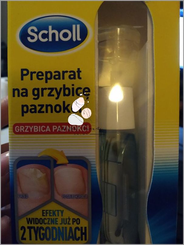 Scholl Na Grzybicę Paznokci - Zaskakujące Efekty!