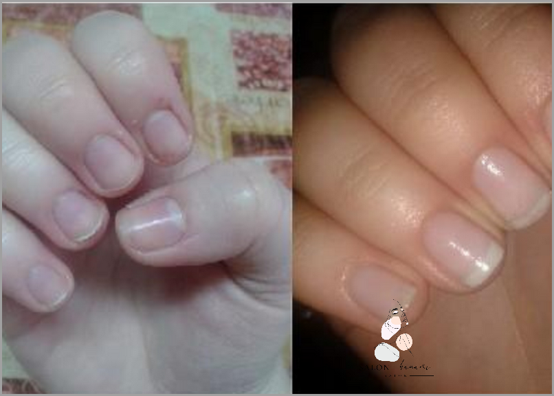 Ujawniamy Efekty Stosowania Regenerum Do Paznokci!