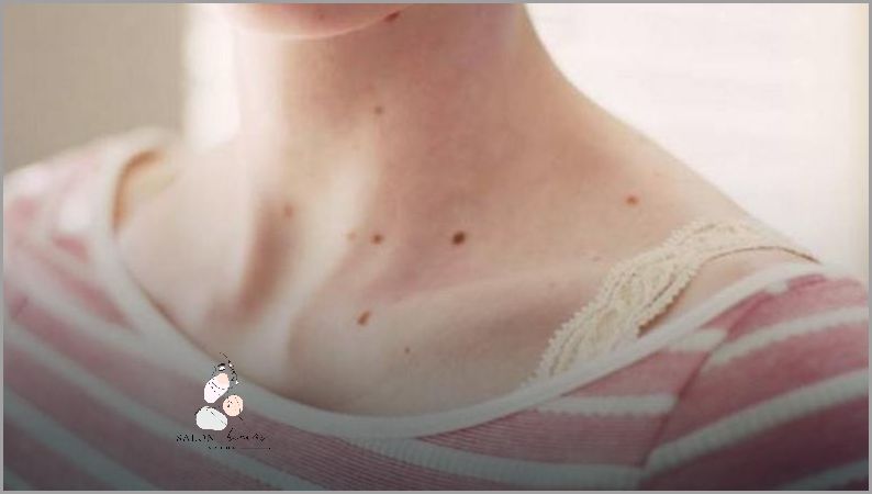 Wit A Na Co? Przekonaj się co to jest!