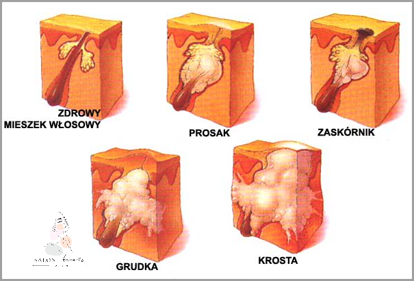 Wszystko o Ciemnych Wargach Sromowych!