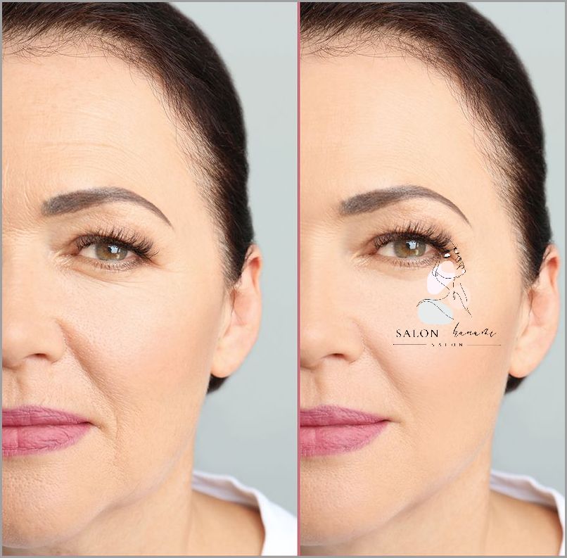 Zaskoczą Ciebie Efekty Stosowania Kwasów Na Twarz!