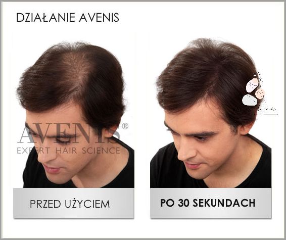 Odżywka Która Rozwiąże Plączące Się Włosy!