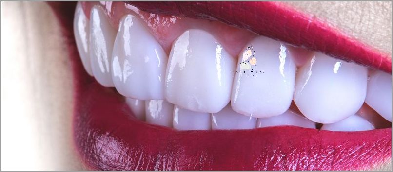Niesamowite Efekty Spilowanych Zębów Pod Licówki!