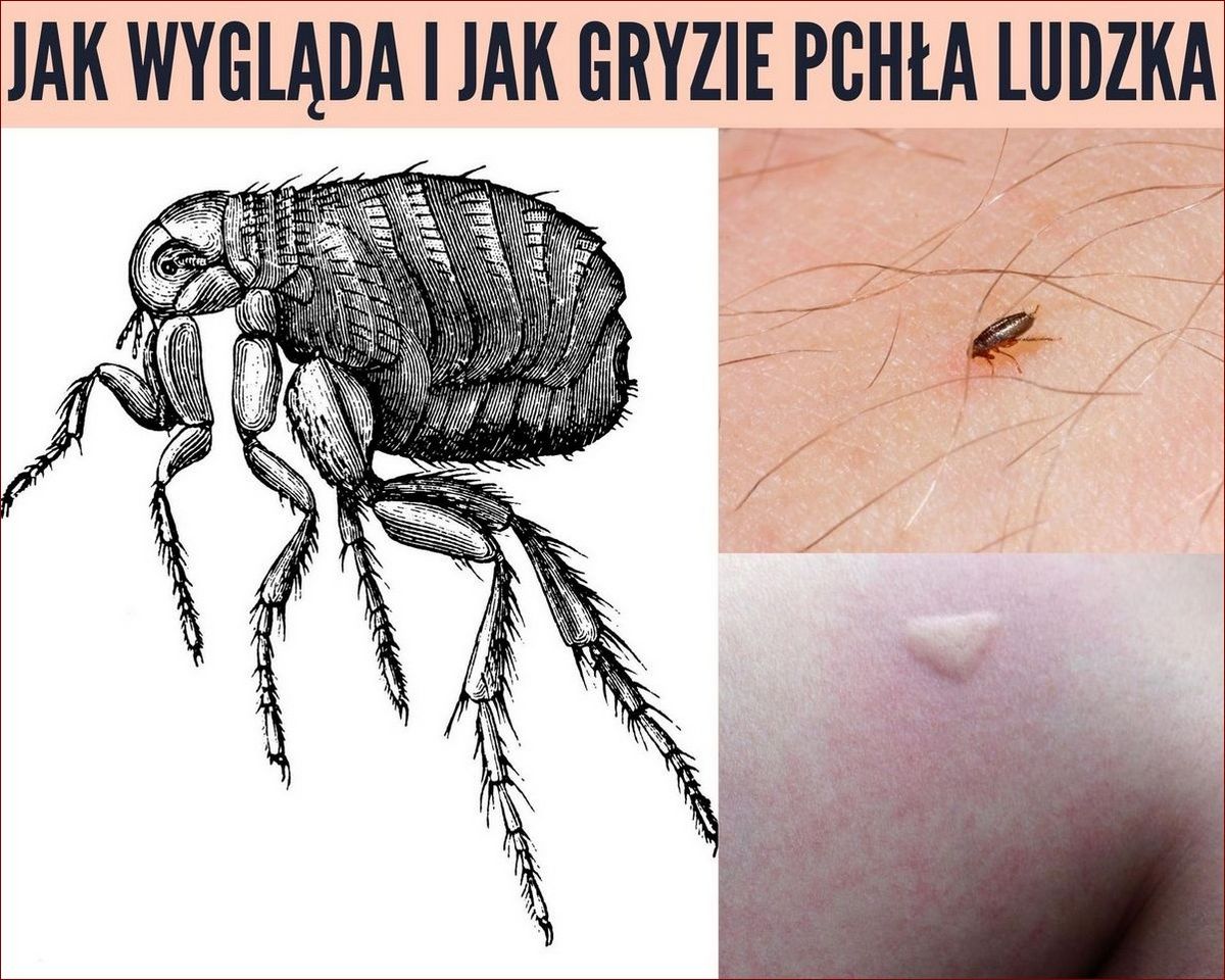 Jak wygląda pchła? Odkryj niezwykłą budowę tych małych, ale uciążliwych pasożytów! () Jak wygląda pchła? Odkryj niezwykłą budowę tych małych, ale uciążliwych pasożytów!