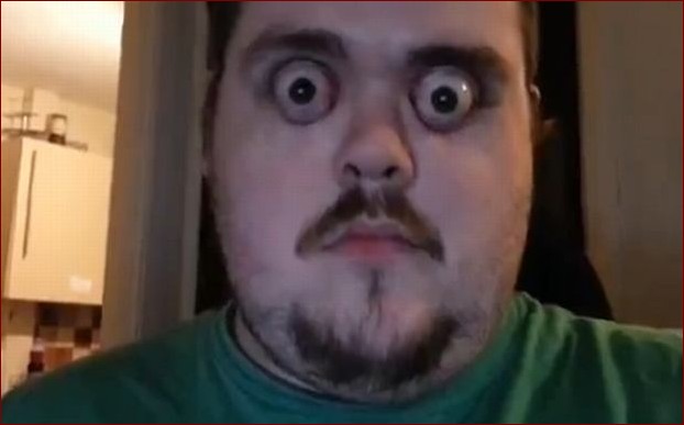 Dziwne oczy u kota: Od czego zależy ich wygląd i jak je leczyć?