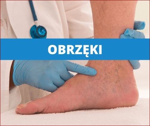 Opuchlizna po ukłuciu kolcem róży - jak sobie z nią poradzić? Skuteczne sposoby